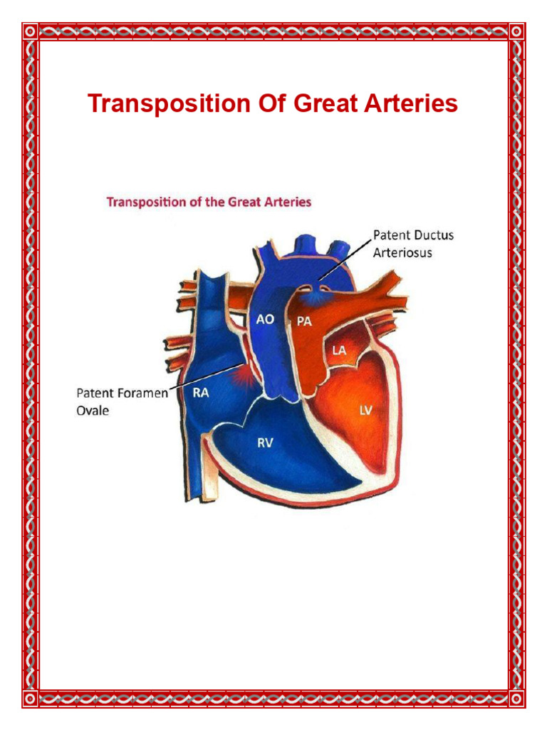 Transposition of Great Arteries, PDF | PDF | Heart | Cardiovascular System