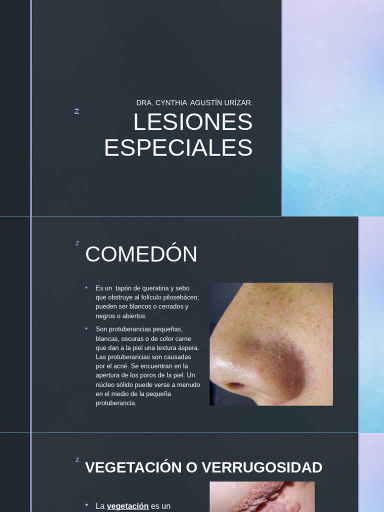 Vegetación y Verrugosidad en Dermatología | PDF