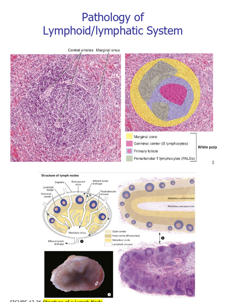 2025-03 Path-Spring-lymphoid and Lymphatic System | PDF | Lymph Node ...