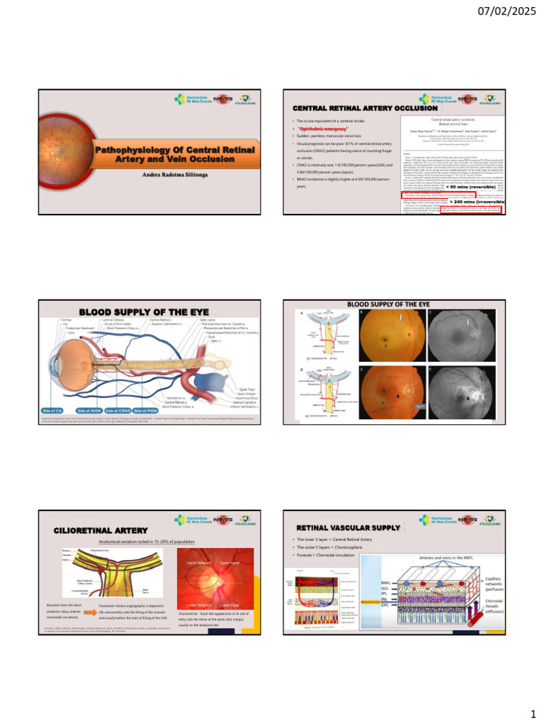 Central Retinal Artery Occlusion Overview | PDF | Retina | Angiology