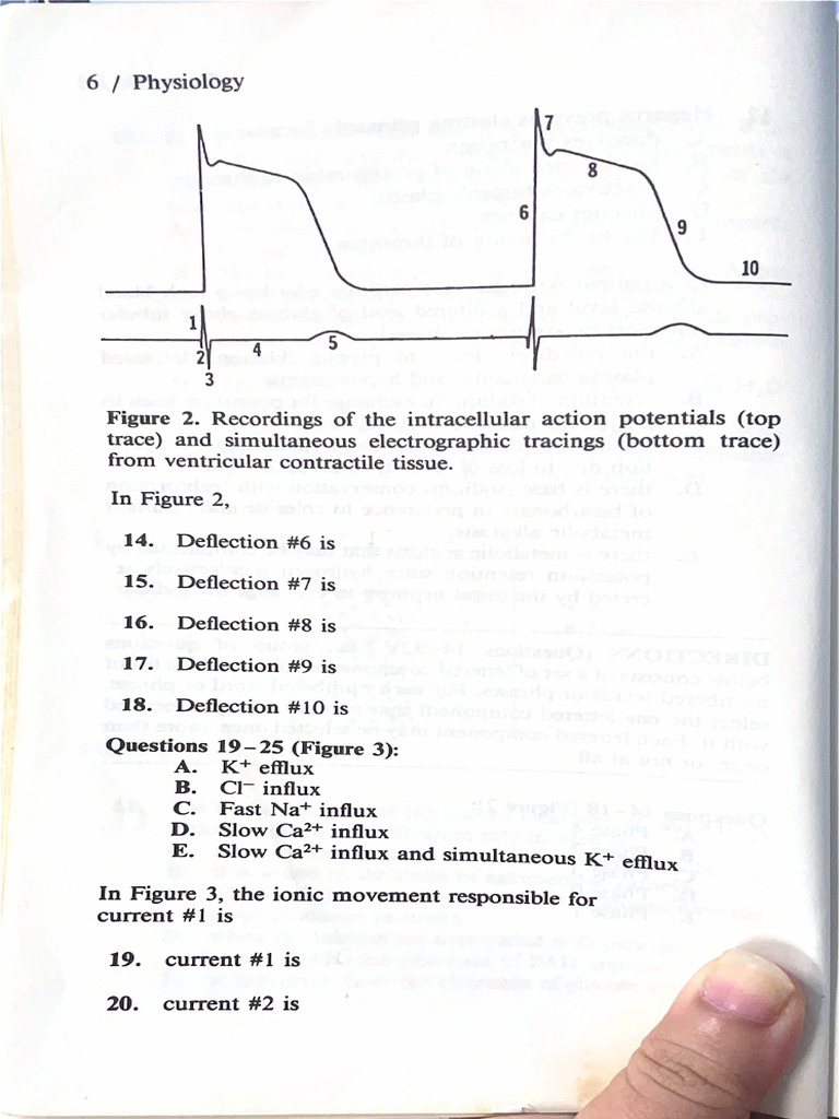 Trace) and Simultaneous Electrographic Tracings (Bottom Trace) | PDF