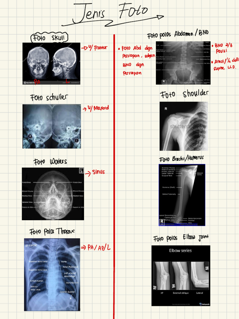 Jenis Foto Radiologi | PDF