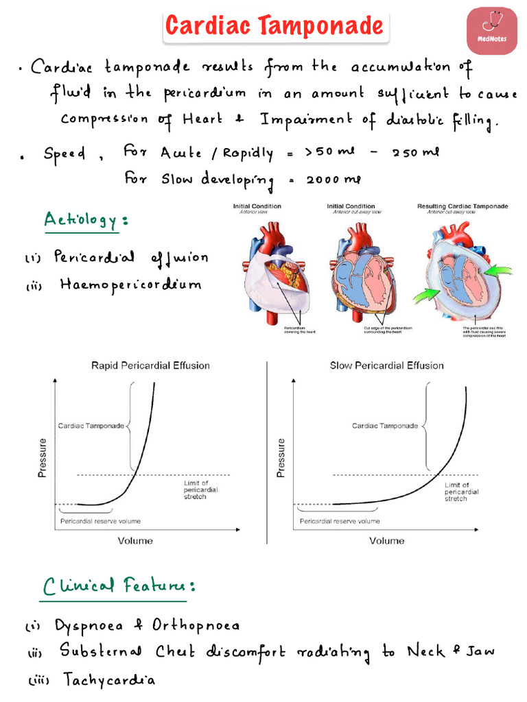Cardiac Tamponade | PDF