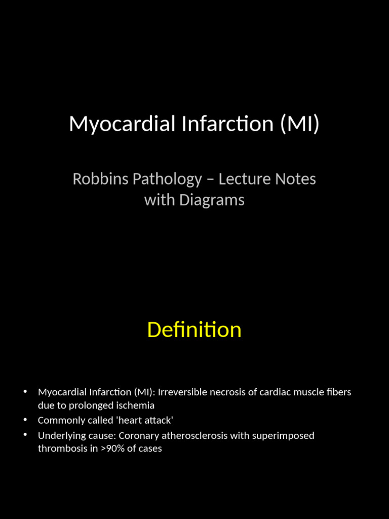 Myocardial Infarction Overview and Treatment | PDF | Myocardial ...