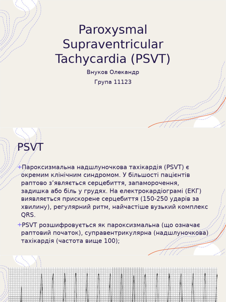 Paroxysmal Supraventricular Tachycardia | PDF