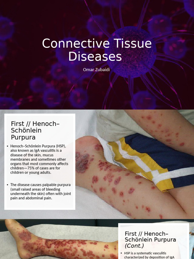 Overview of Connective Tissue Diseases | PDF | Immune System Disorders ...