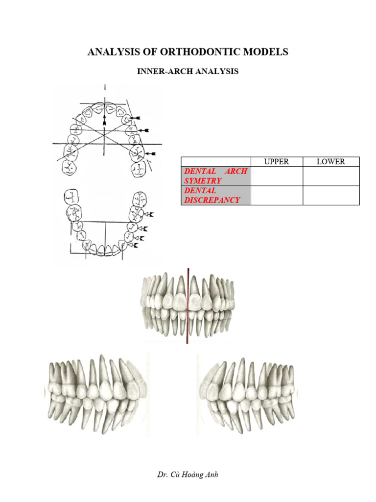 Orthodontic Model Analysis Techniques | PDF