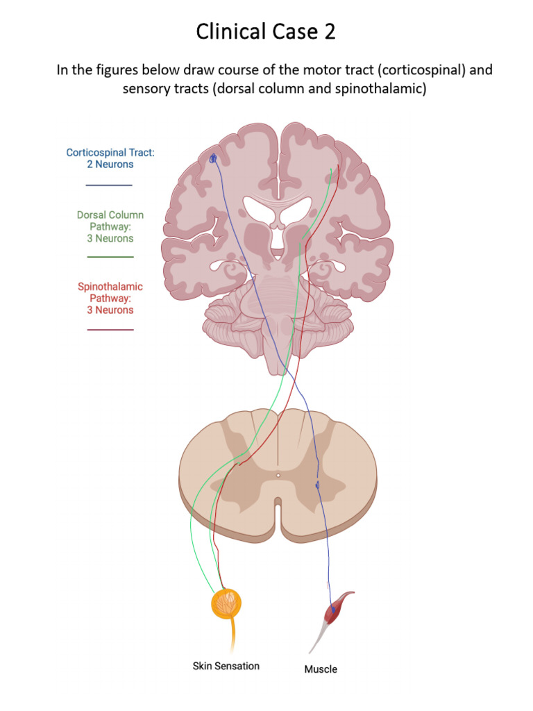 Case2 Drawing | PDF