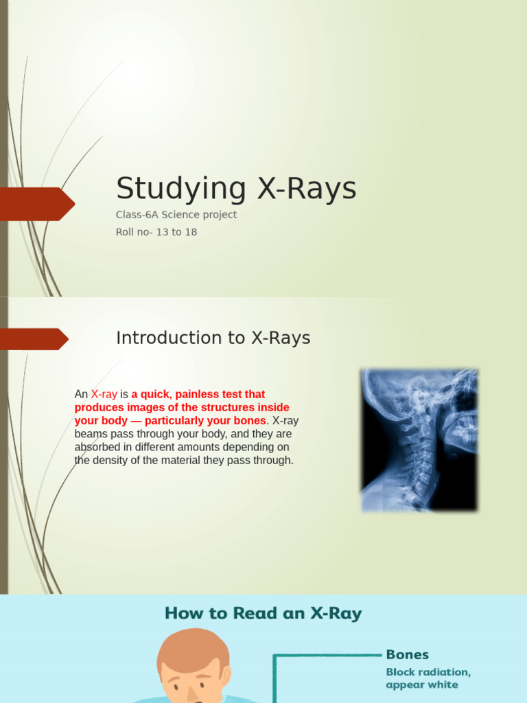 Understanding X-Rays and Fractures | PDF