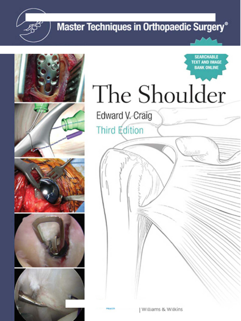 Shoulder Surgery Techniques Overview | PDF | Orthopedic Surgery | Food ...