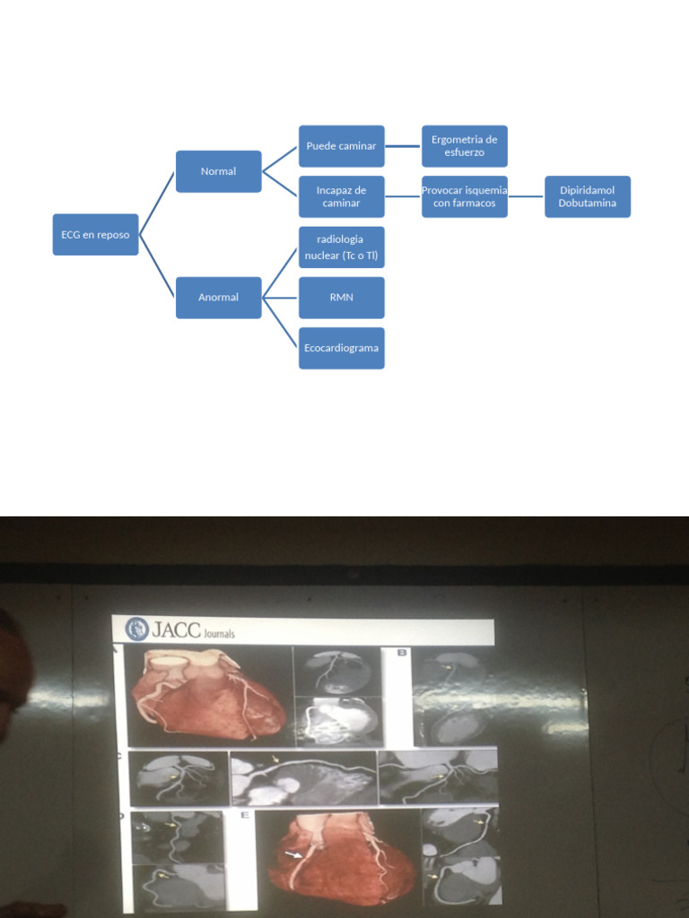 Ergometría: Evaluación del Esfuerzo Cardiaco | PDF