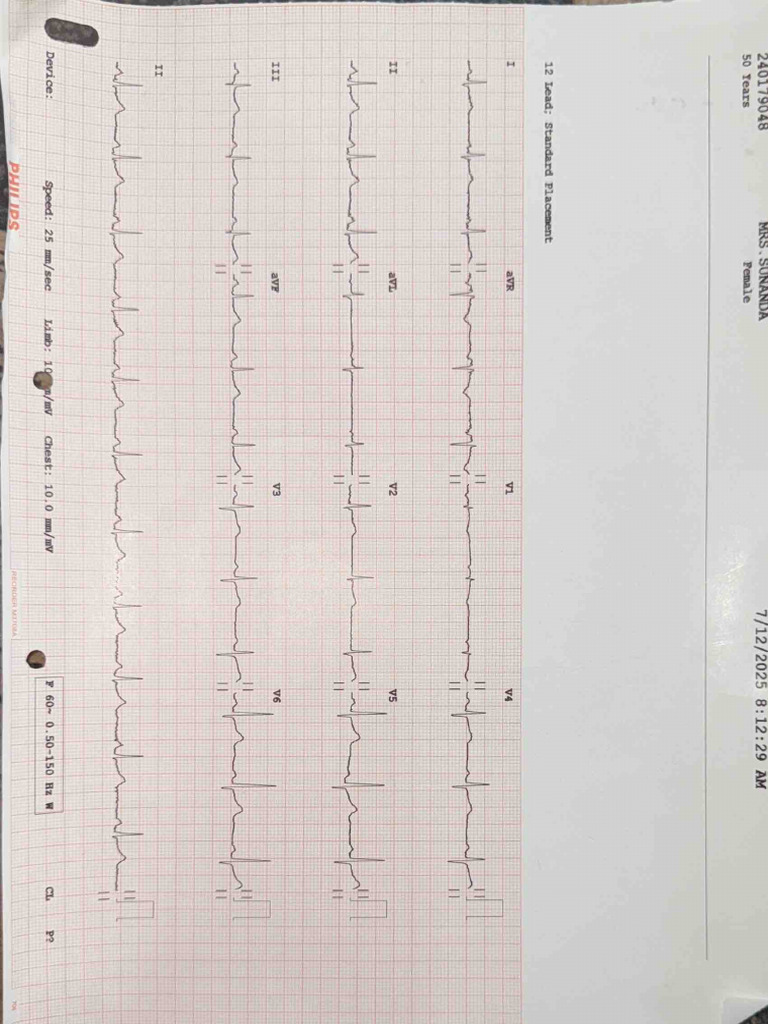 12-Lead ECG Report for SO Yeus | PDF