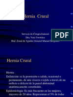 Hernia Crural