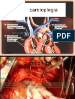 Cardioplegia 