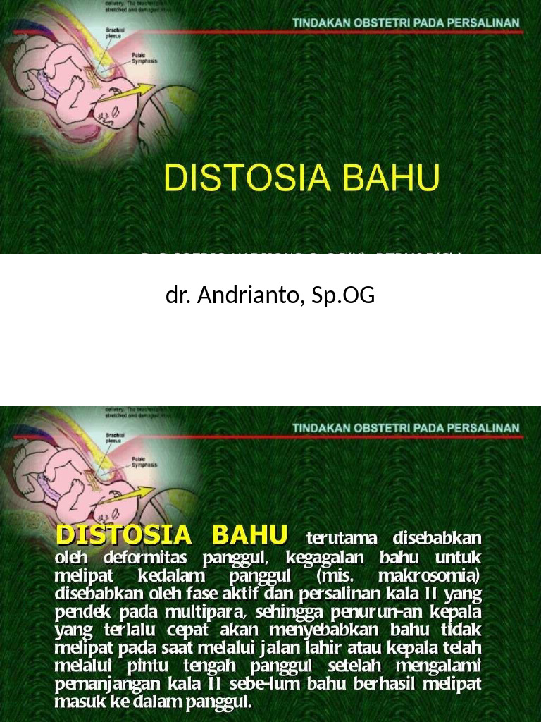 PDF 03 Distosia Bahu | PDF