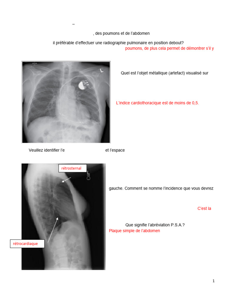 Corrigé Examen Radiographies Médicales | PDF | Poumon | Radiographie