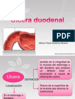 Ulcera Duodenal