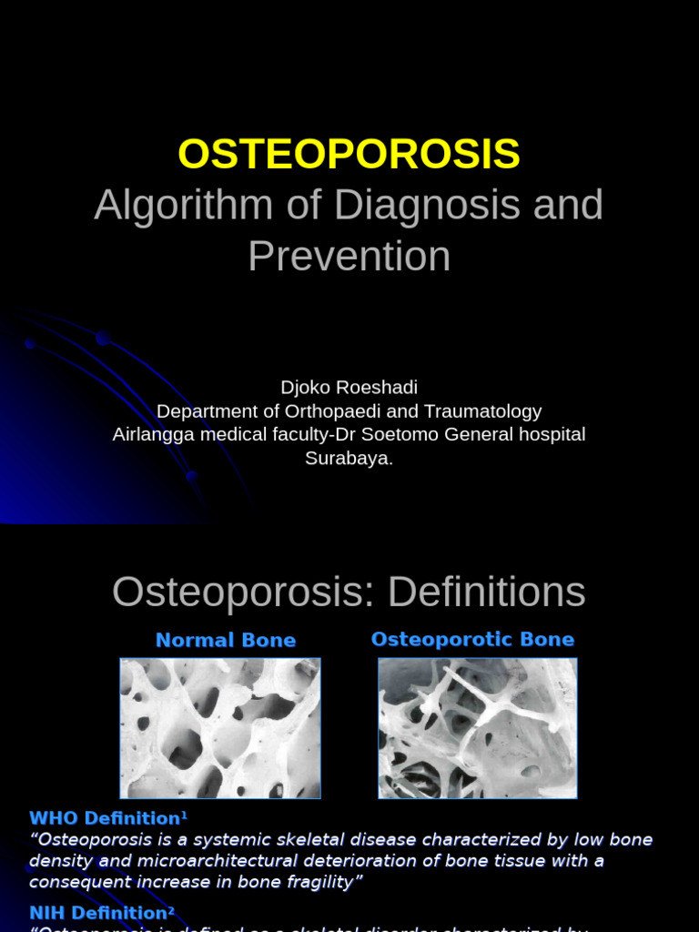 Osteoporosis Diagnosis and Prevention Guide | PDF | Osteoporosis | Bone