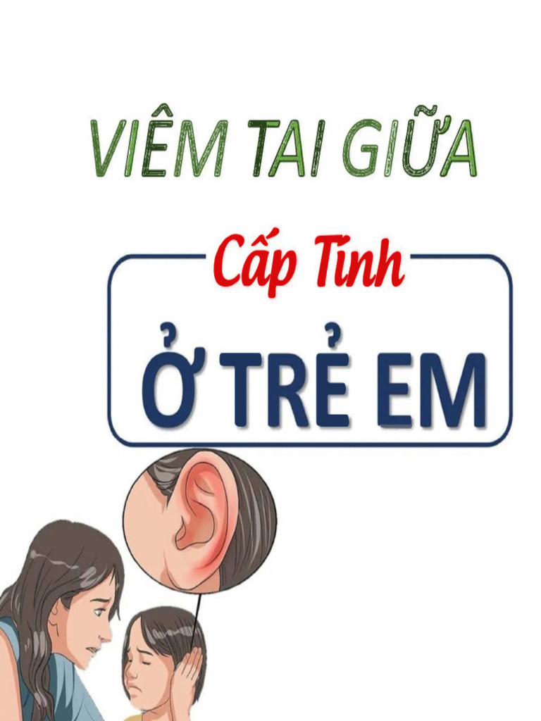 Viêm Tai Giữa Cấp Tính Ở Trẻ em | PDF