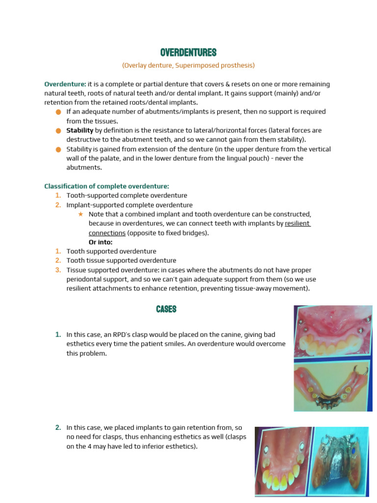 Overview of Overdentures and Their Use | PDF | Dental Implant | Dentures