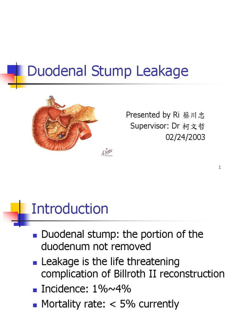 Duodenal Stump Leakage Surgery Stomach Free 30day Trial Scribd