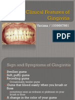 Clinical Features of Gingivitis