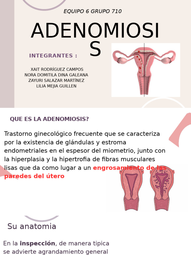 Adenomiosis | PDF | La salud de la mujer | Anatomia sexual