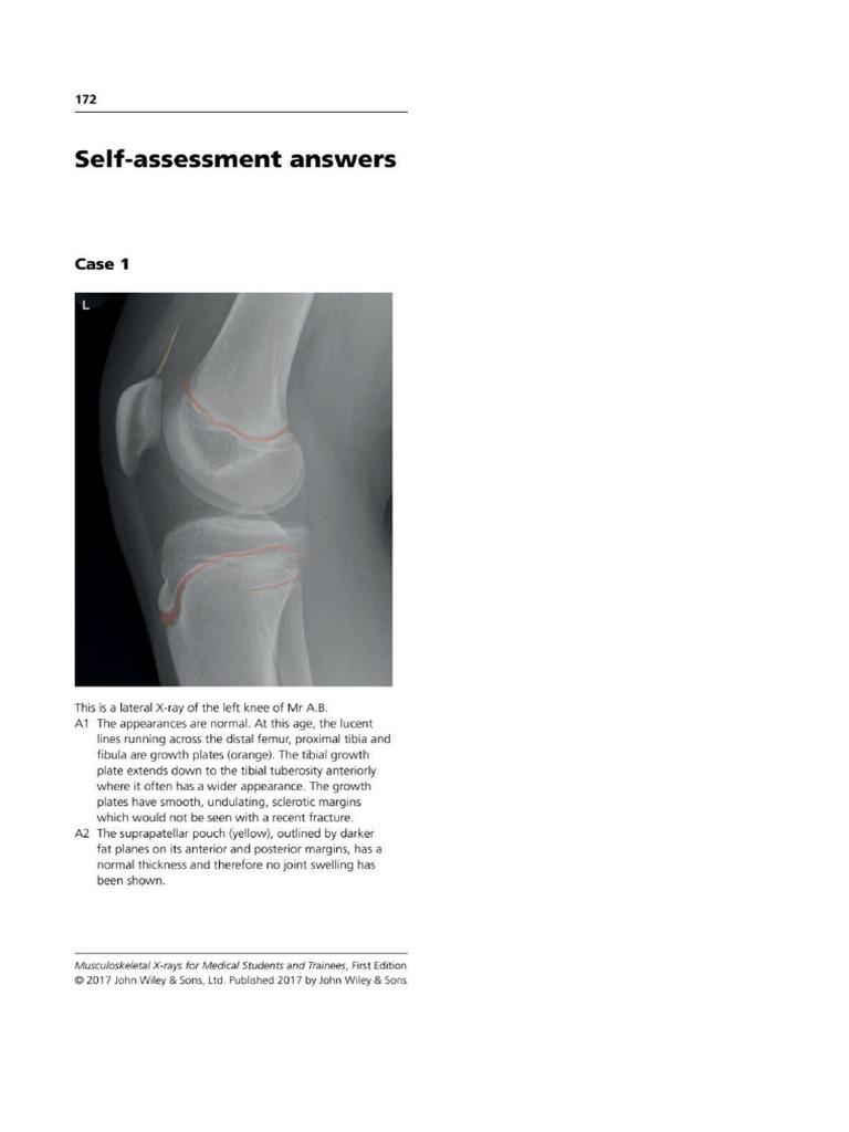Ortho PG 160 | PDF