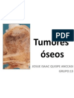 Tumores_OSEOS