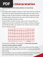 12 Lead ECG Analysis for STEMI | PDF | Electrocardiography | Visual Cortex
