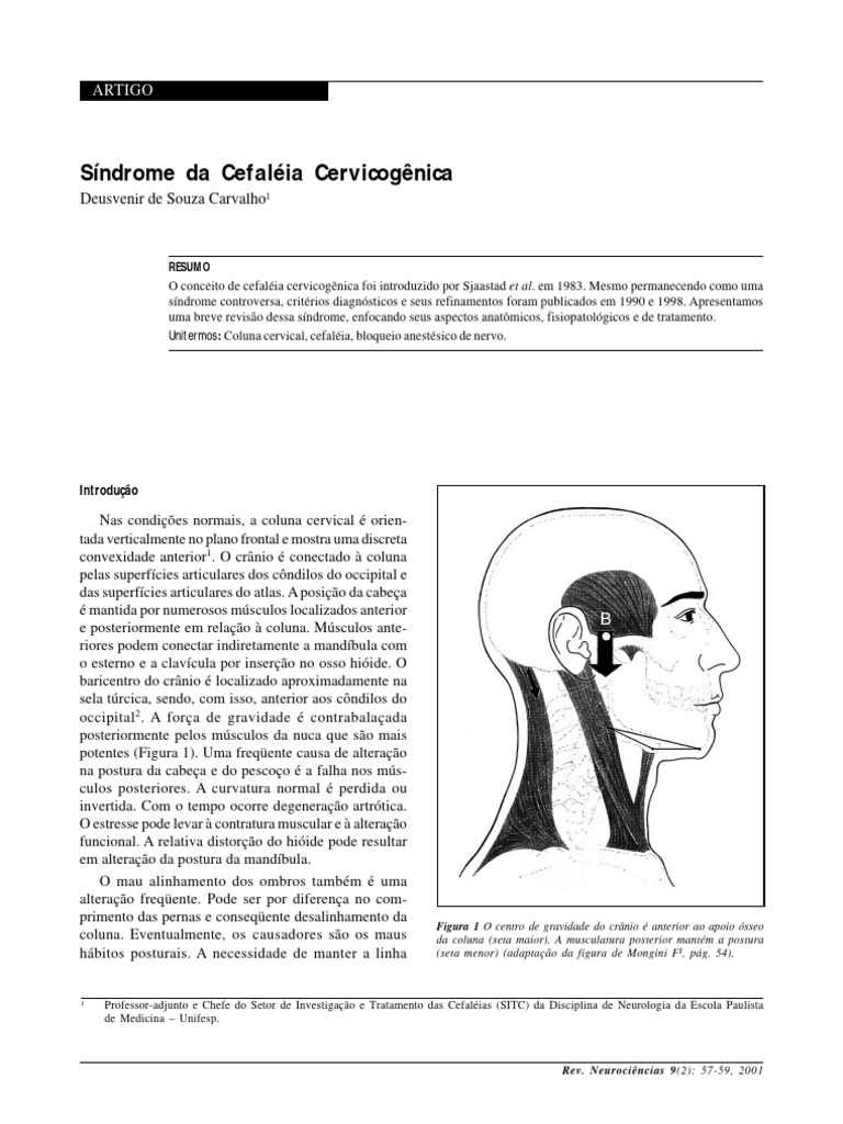 Cefaléia Cervicogênica: Diagnóstico e Tratamento | PDF | Dor | Enxaqueca