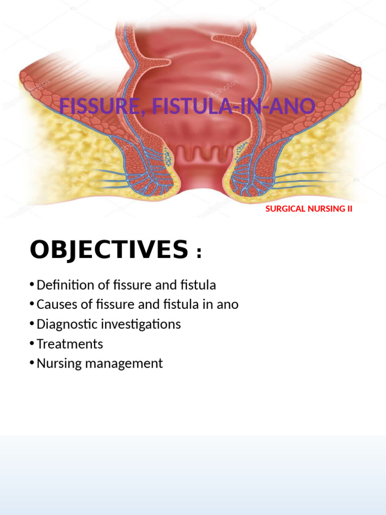 Fissure and Anal Fistula | PDF | Diseases And Disorders | Medical ...