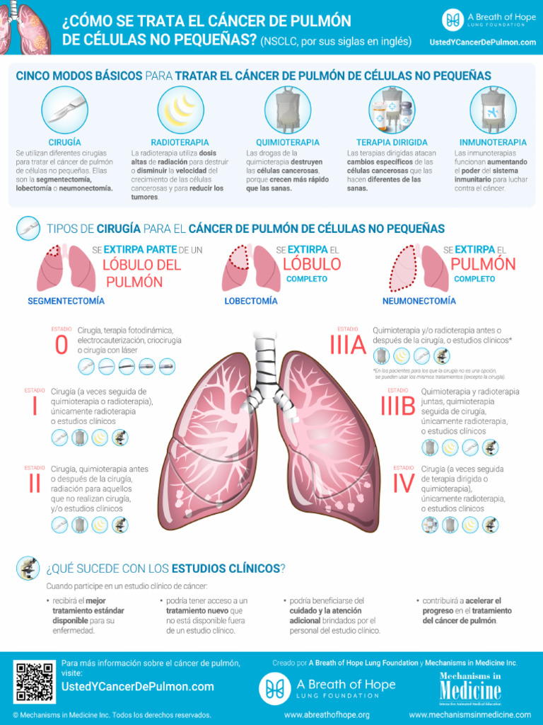 Non Small Cell Lung Cancer Treatment Infographic | PDF