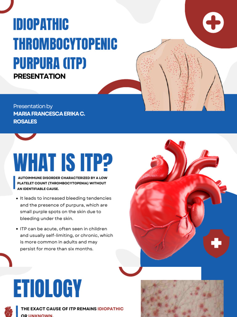 Understanding Idiopathic Thrombocytopenic Purpura | PDF | Medical ...