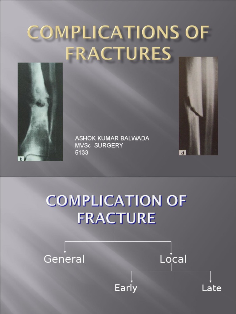 Complication of Fracture Bone Musculoskeletal System