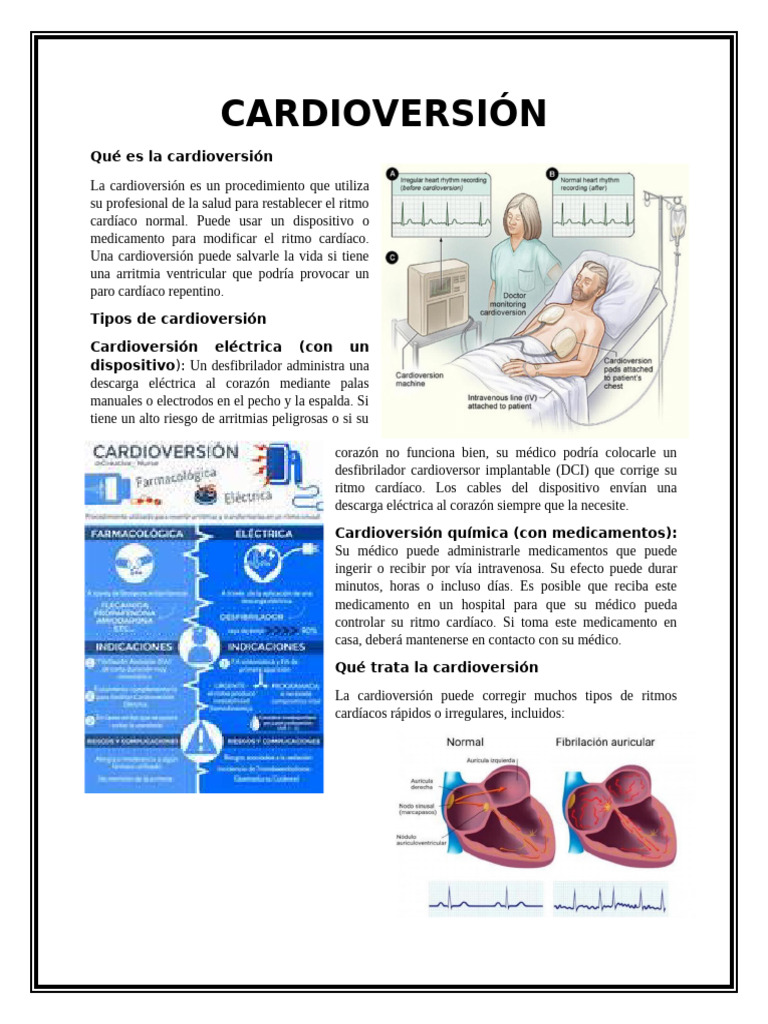 Procedimiento de Cardioversión: Guía Completa | PDF | Corazón ...