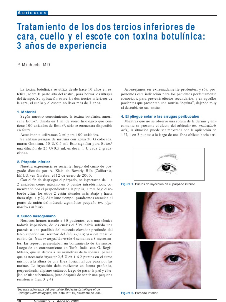 Articulo Botox | PDF | Anatomía humana | Anatomía de los primates