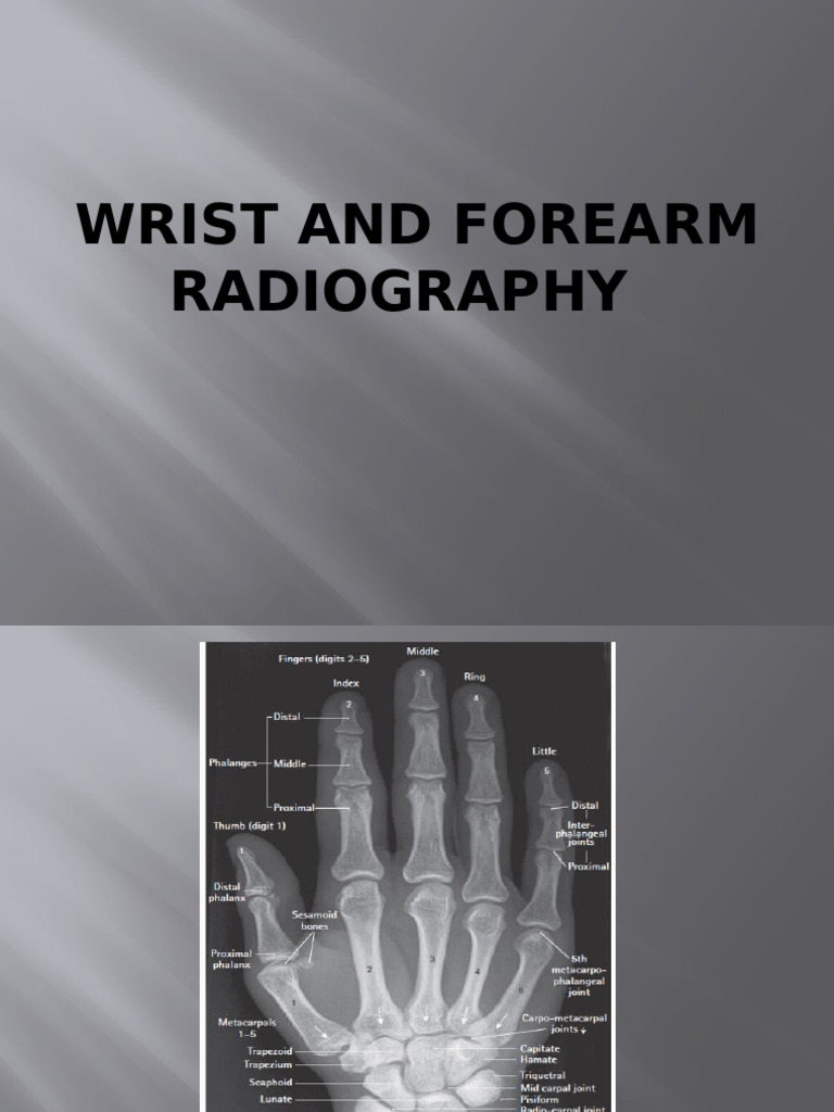 3-Wrist and Forearm Radiography | PDF | Hand | Elbow