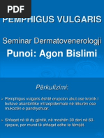 Download Pemphigus Vulgaris Seminar Dermatovenerologji nga Agon Bislimi AgBi by Agon Bislimi SN91628395 doc pdf