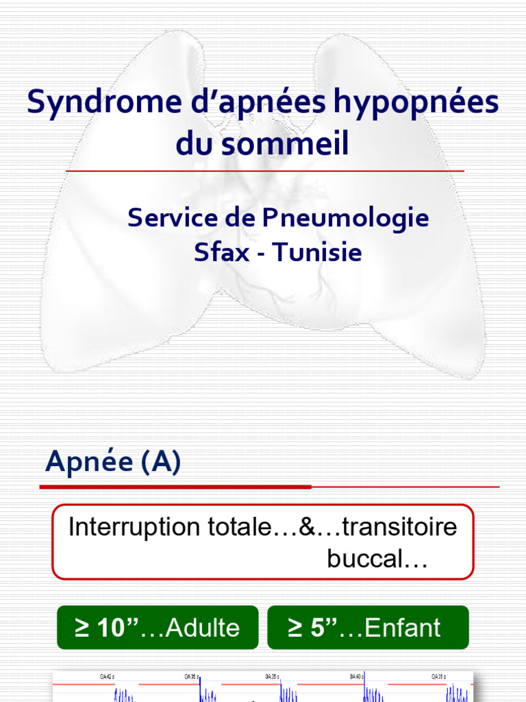 Comprendre le syndrome d'apnées du sommeil | PDF | Syndrome d'apnées du ...
