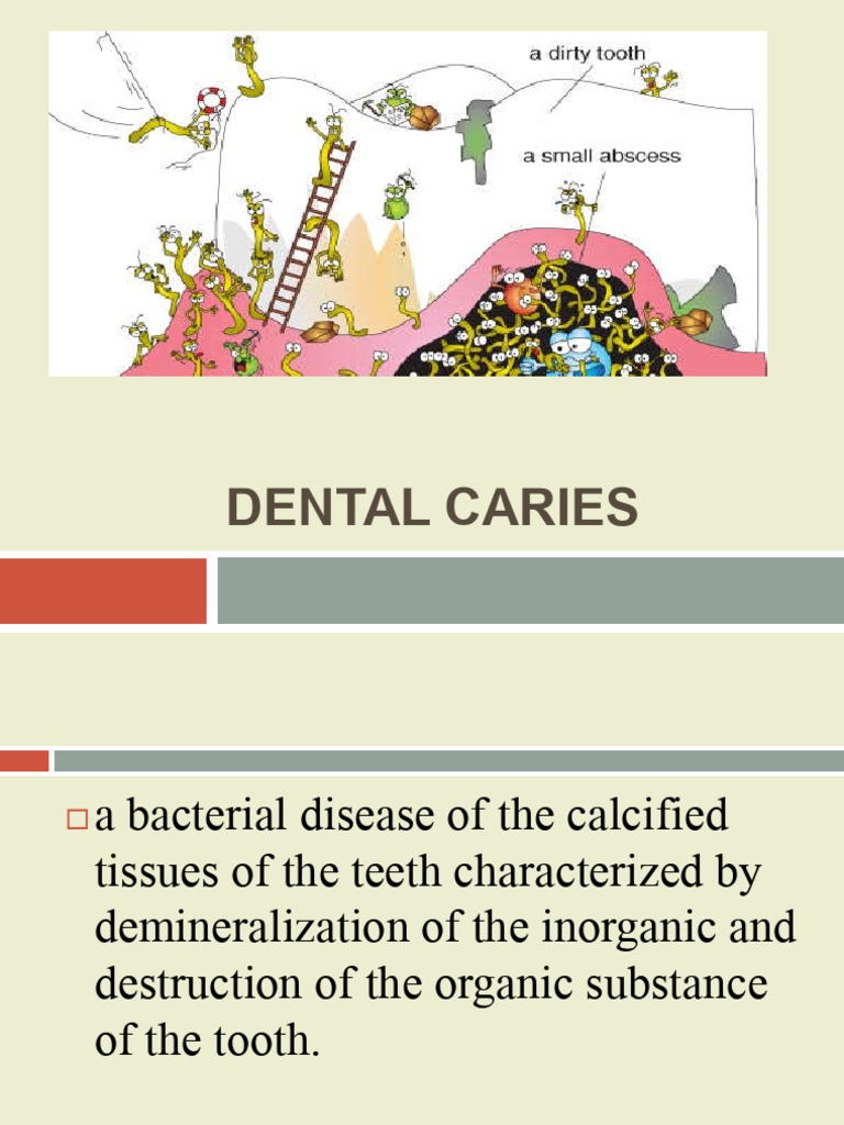 Understanding Dental Caries Theories | PDF | Tooth Enamel | Human Tooth