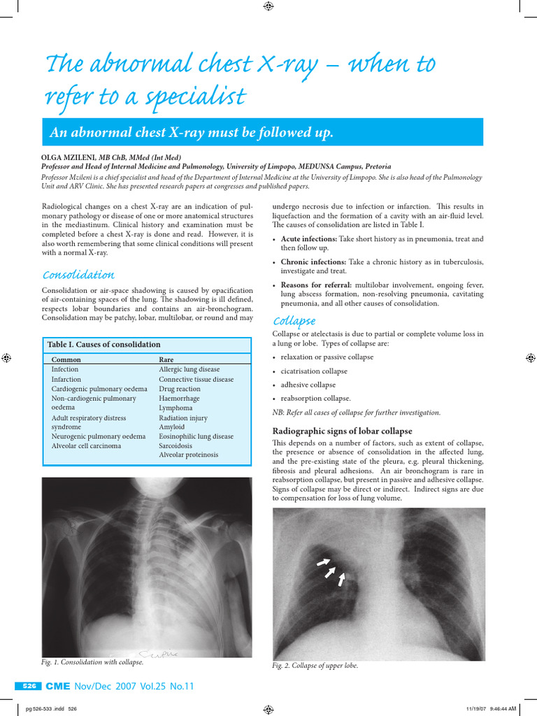 Chest X-Ray Interpretation Guide | PDF | Lung | Respiratory Diseases