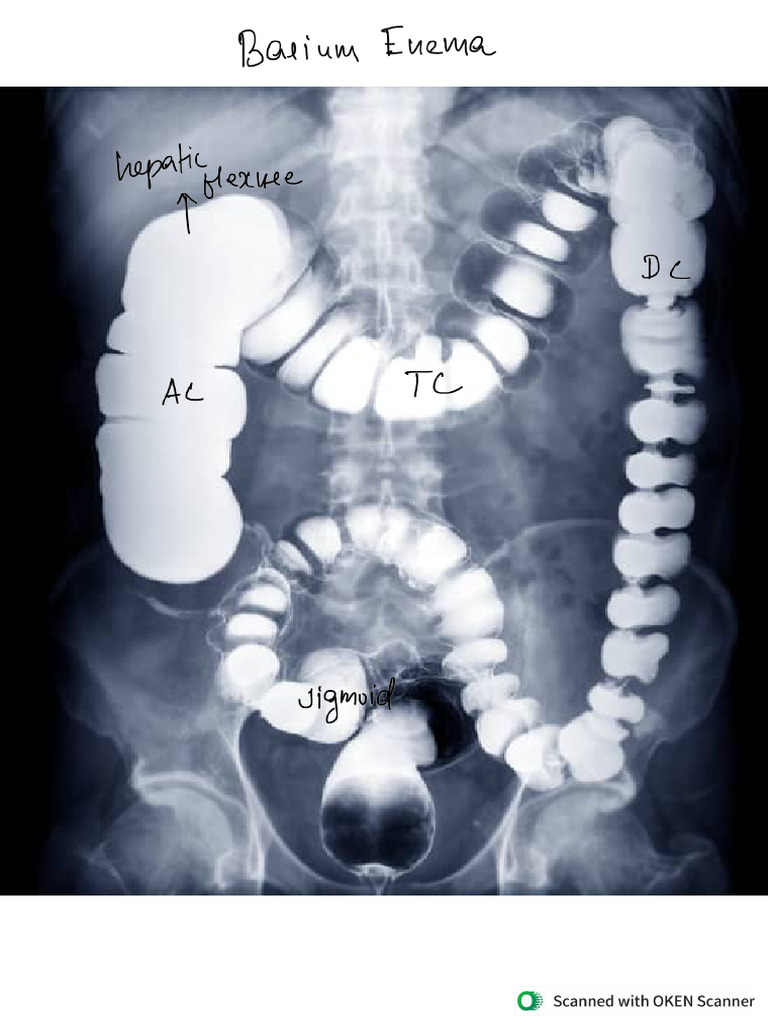 Xray | PDF