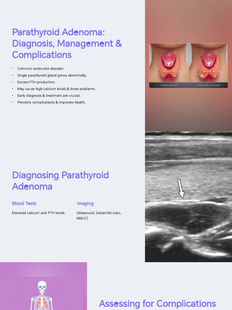 Parathyroid Adenoma: Diagnosis & Treatment | PDF