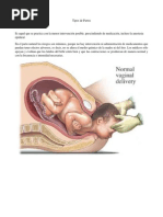 Evaluación Gestacional: Método Capurro | PDF | Parto prematuro ...