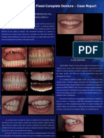 Implanted Suported Fixed Denture
