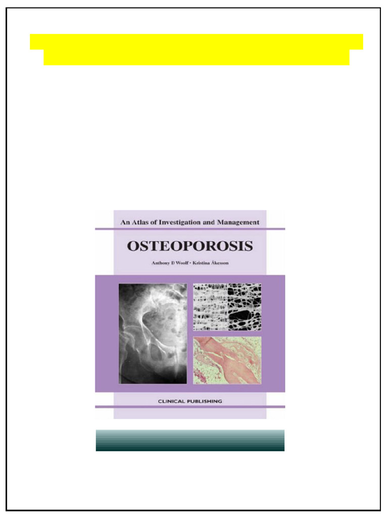 Osteoporosis An Atlas of Investigation and Diagnosis 1st Edition ...