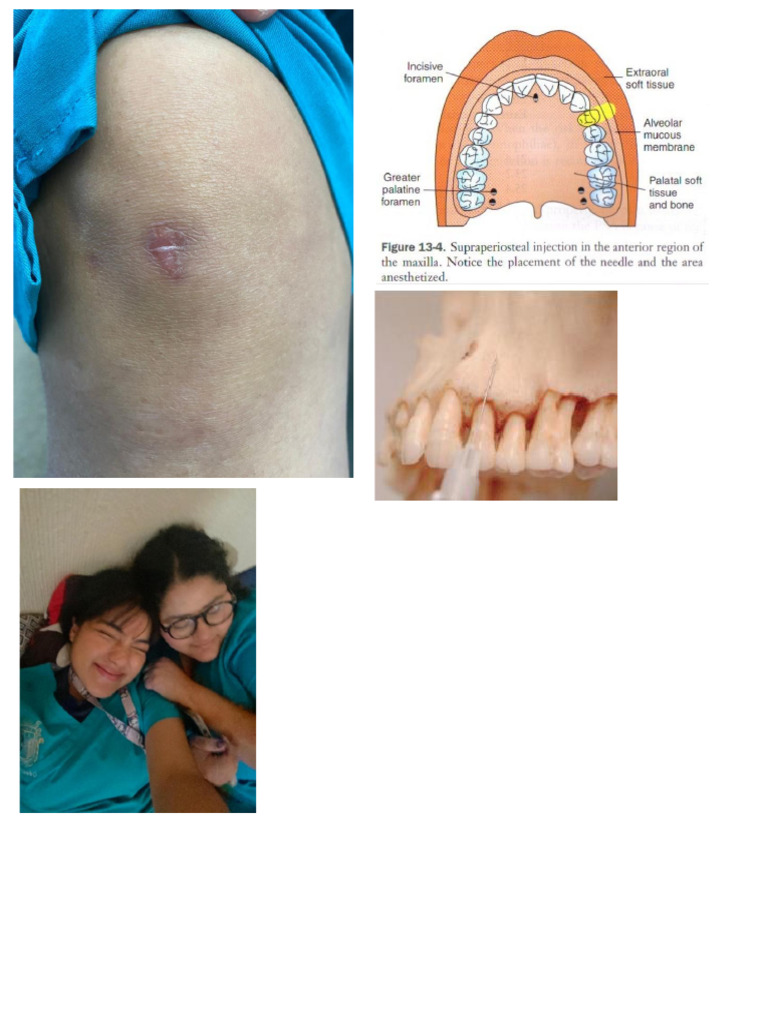 Lesion | PDF