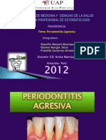 Periodontitis Agresiva Exposicion