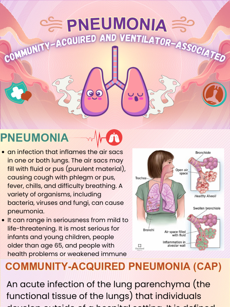 Types and Management of Pneumonia | PDF | Pneumonia | Respiratory Diseases